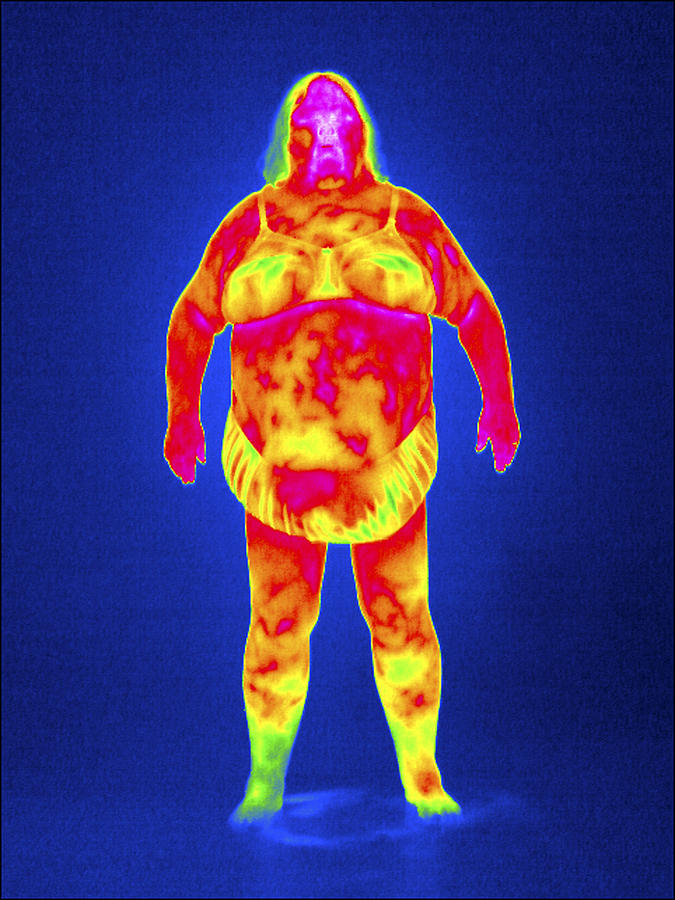 6-obese-woman-thermogram-tony-mcconnell.jpg